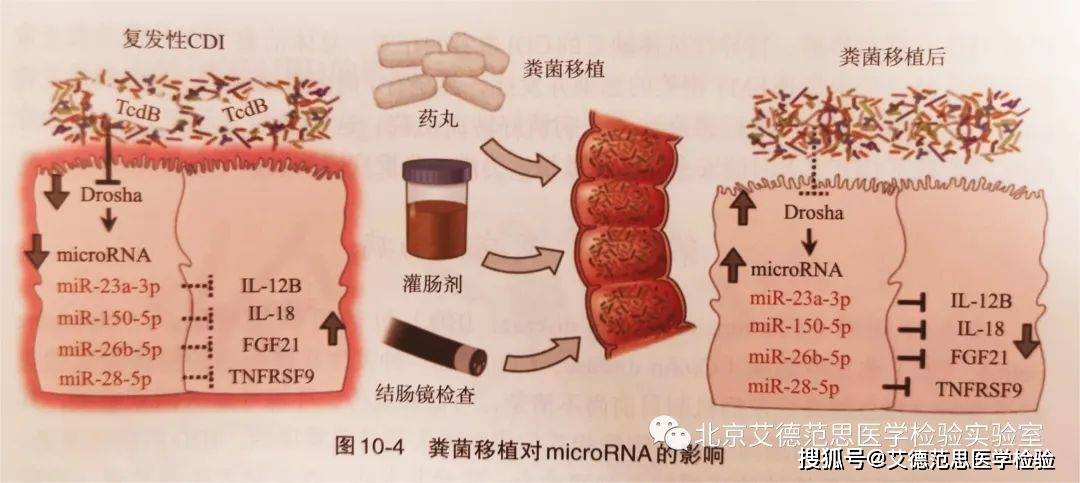 粪便移植最新,粪便移植最新，一场奇妙的友情之旅