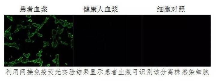 中山最新冠状病毒全面防护指南与技能学习